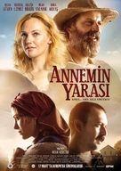 Annemin Yarasi - German Movie Poster (xs thumbnail)