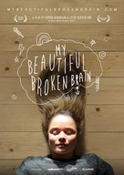 My Beautiful Broken Brain - Movie Poster (xs thumbnail)