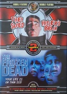 They Saved Hitler&#039;s Brain - DVD movie cover (xs thumbnail)
