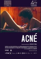 Acn&eacute; - Movie Poster (xs thumbnail)