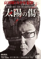 Taiy&ocirc; no kizu - Japanese DVD movie cover (xs thumbnail)