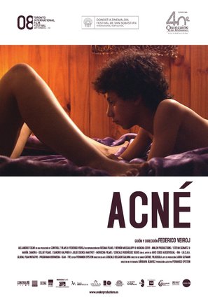 Acn&eacute; - Spanish Movie Poster (thumbnail)