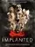Implanted poster thumbnail